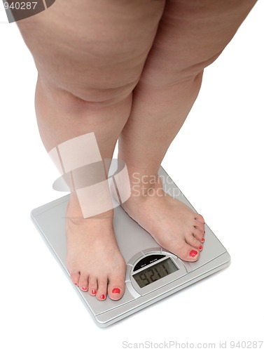 Image of women legs with overweight