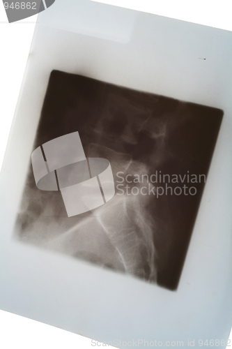 Image of Medical X-ray of spine