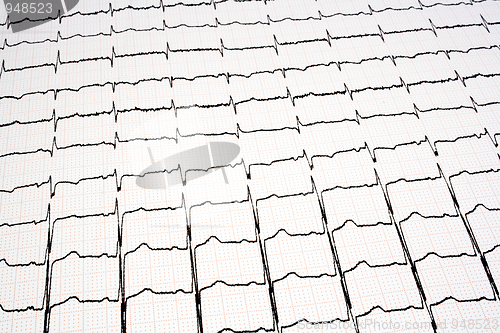 Image of ECG - EKG graph