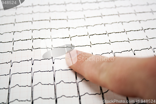 Image of ECG graph