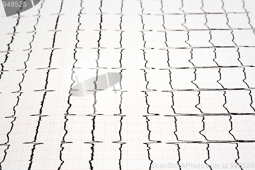 Image of ECG print