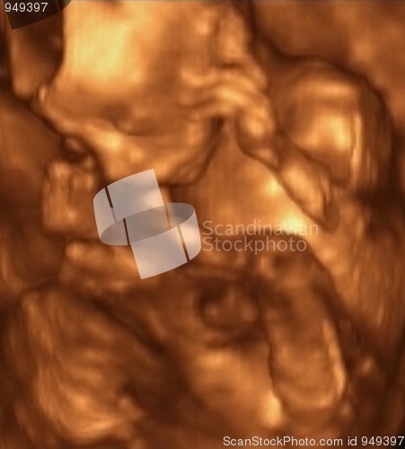 Image of Three Dimensional Ultrasound