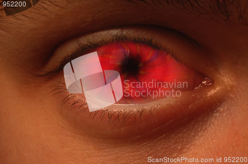 Image of Red Vortex in an eyeball