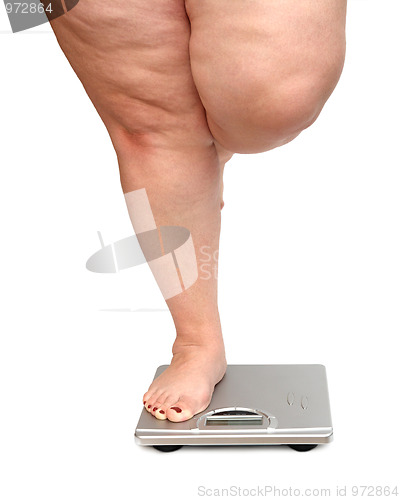 Image of women legs with overweight