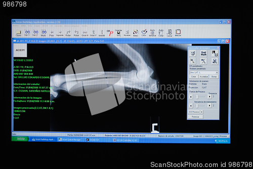 Image of X-ray of a dog's leg