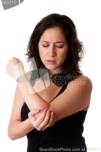 Image of Woman with elbow pain