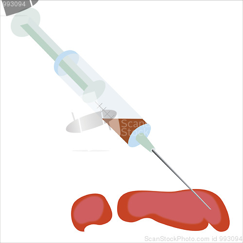 Image of Blood in syringe