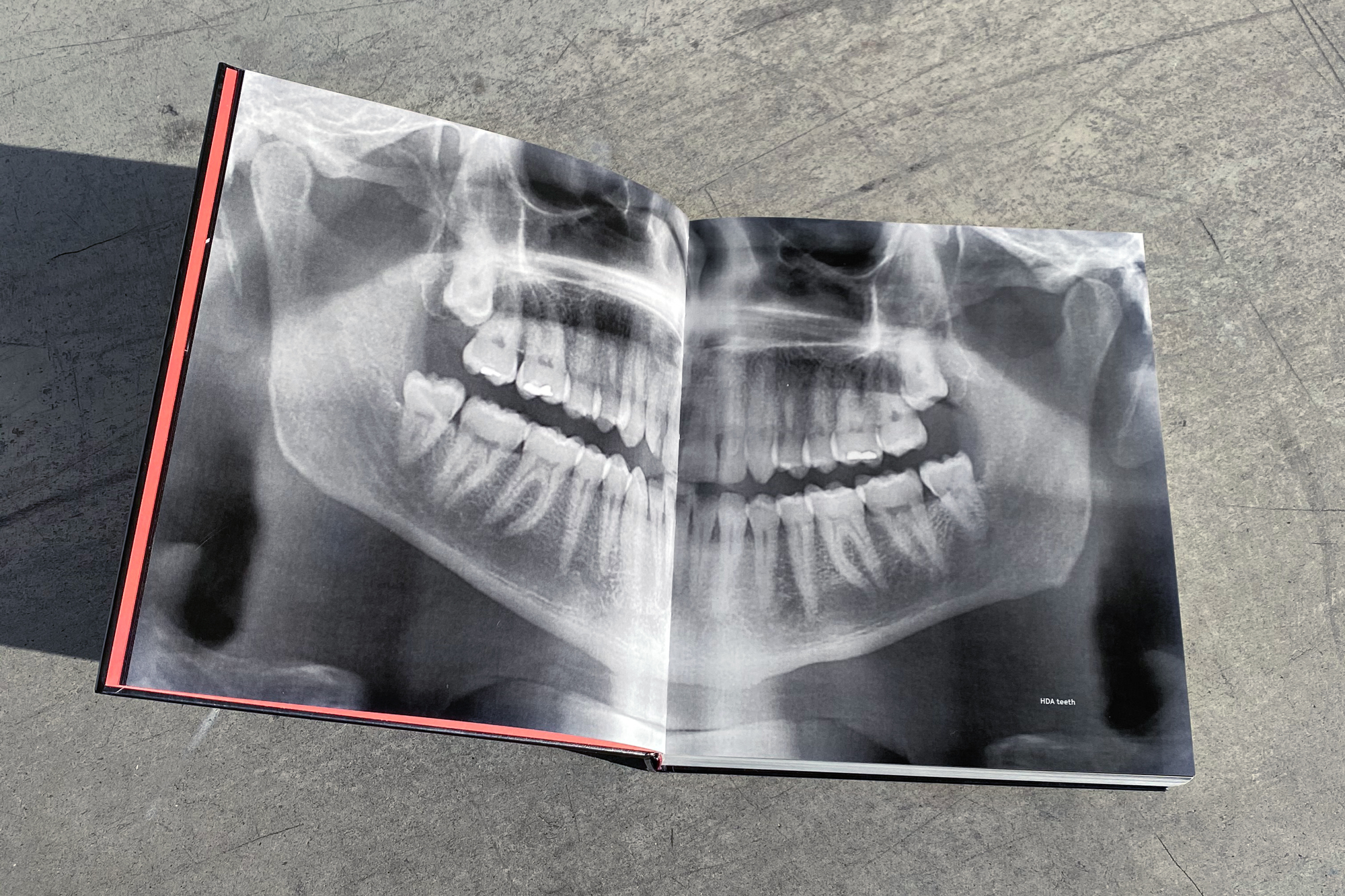 book spread with teeth x-ray