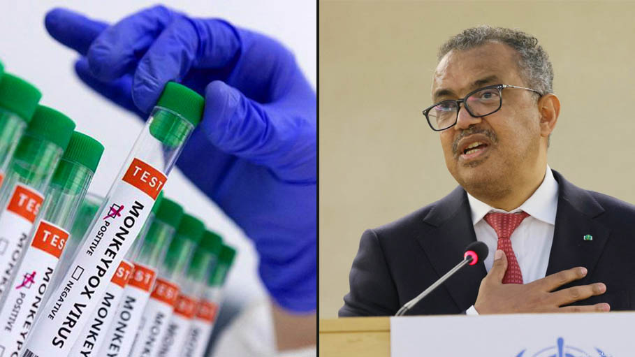 World Health Org Chief Warns of Monkeypox Risk in Non-Endemic Countries