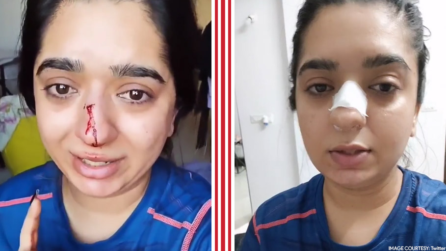 Bangalore Woman Accuses Zomato Delivery Man of Assaulting Her in a Video