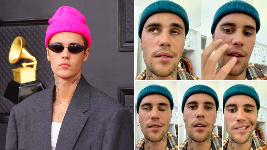 "Body Telling Me to Slow Down": Justin Bieber on Facial Paralysis