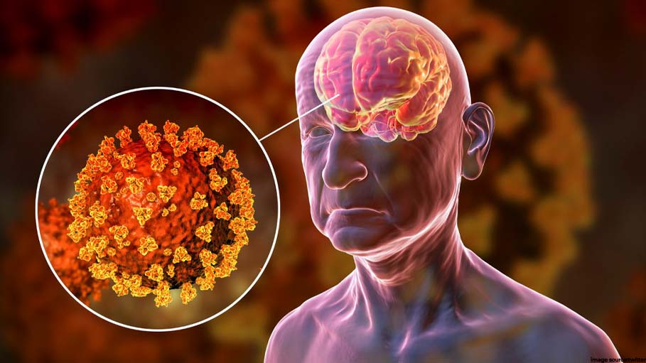 Autopsies Show Covid Virus Lingers in Brain for Months