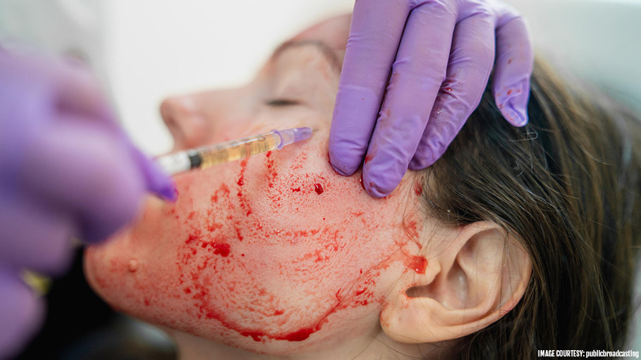 Consumers in Albuquerque Spa Who’ve Undergone ‘Vampire Facials’ Will Have to Test for HIV Says Health Department