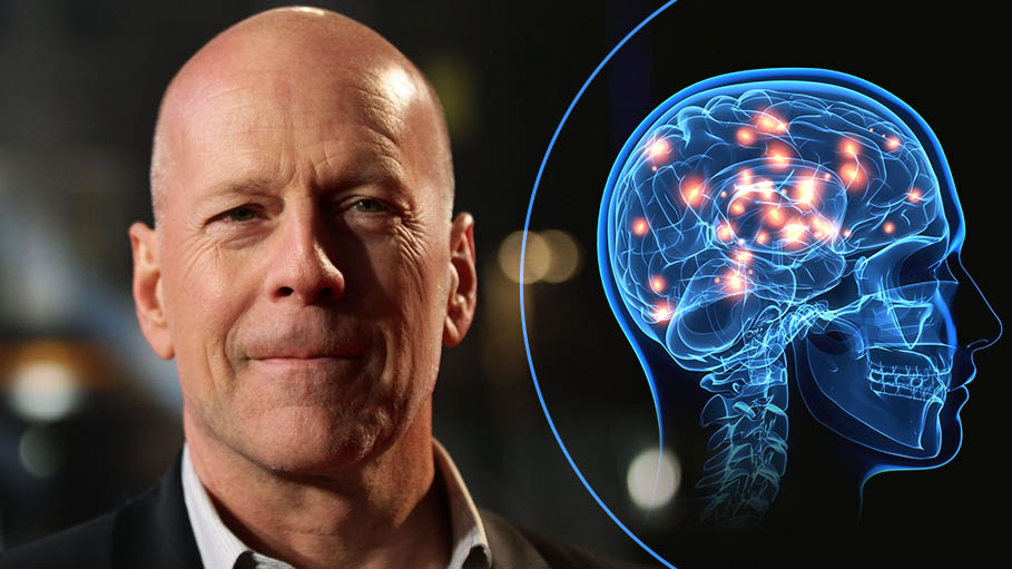 Bruce Willis Steps away from Acting Career after Being Diagnosed with Aphasia