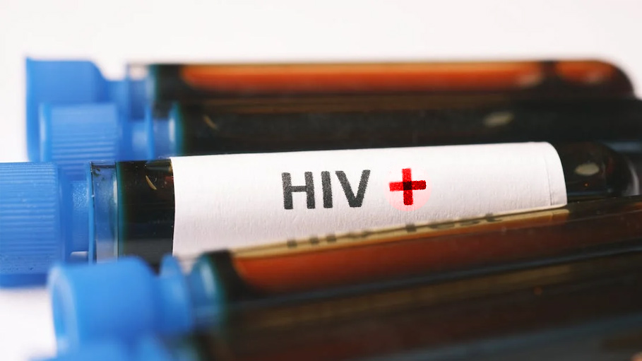 HIV+ Man with Cancer Cured of Both after Stem Cell Therapy: Study