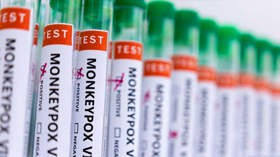 New Yorkers Make Long Queues for Monkeypox Vaccine: Report