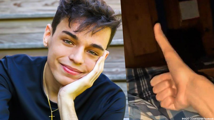 TikTok Star Jacob Pina Went Viral for Giant 5-Inch Long Thumb