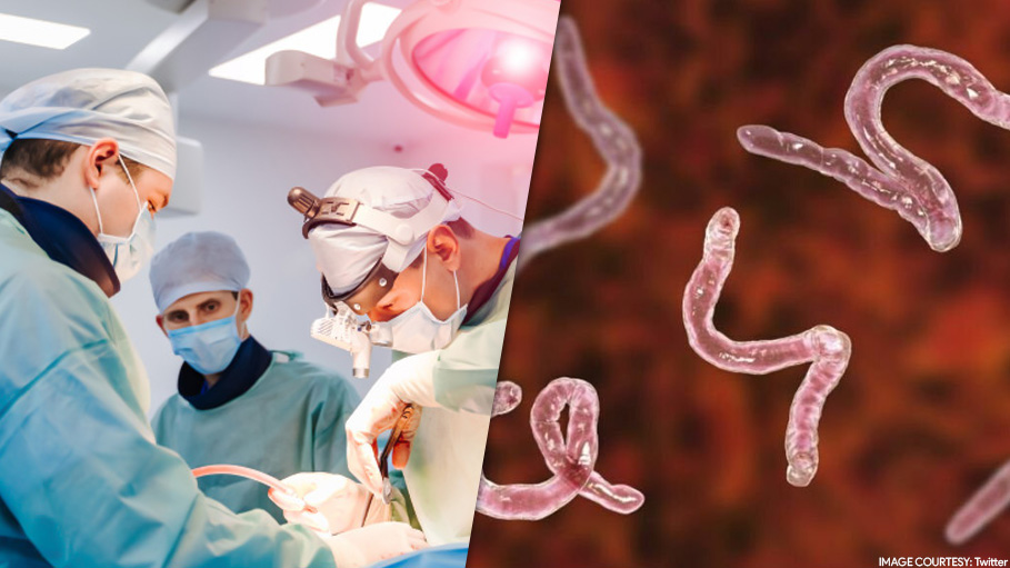 A Man Had a 12-Inch Tapeworm in His Head for 10 Years