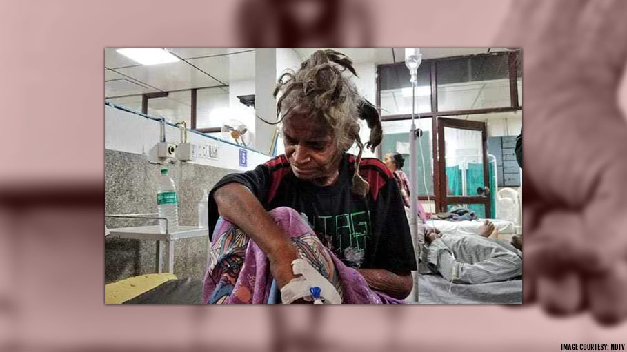 Woman Tortured by Her Brother for Two Years Denying Her Food
