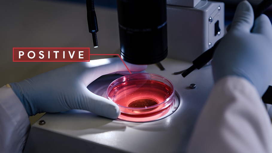 Out of 31,083 Samples Tested, 1,443 Found COVID-19 Positive: ICMR