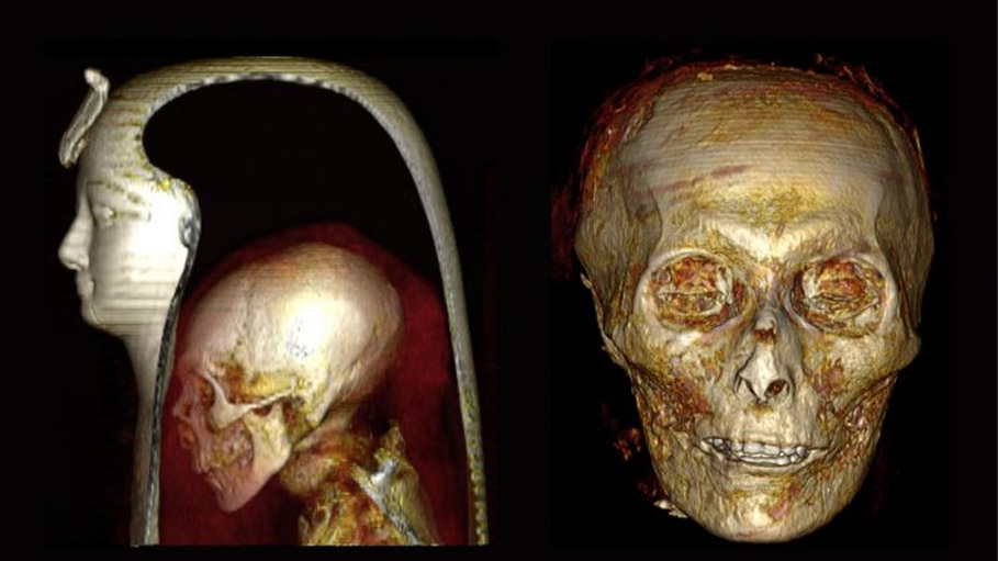 For The First Time a Mummy’s Body is “Digitally Unwrapped”