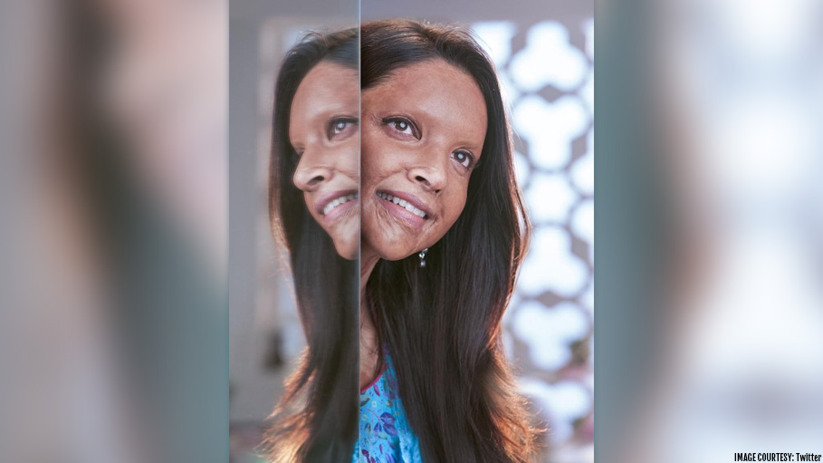 Deepika’s Different Look in ‘Chhapaak’ Is Arousing Curiosity among Movie Buffs