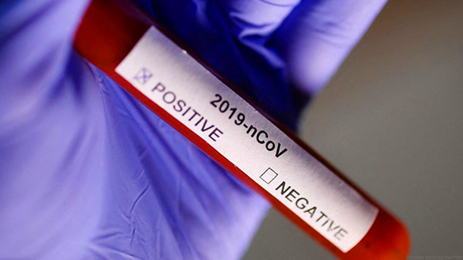 World's First Trial with Voluntary Covid Exposure Found Safe in Young Adults