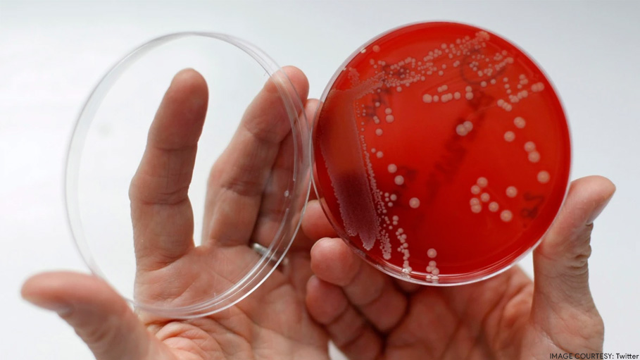 Superbug Infections Killed 1.2 Million People Worldwide in 2019