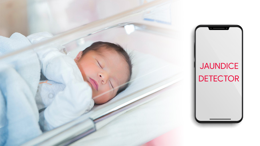 New App to Detect Jaundice in Newborns