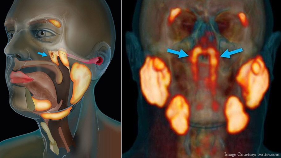 Scientists Discover a New Organ That May Help to Treat Cancer