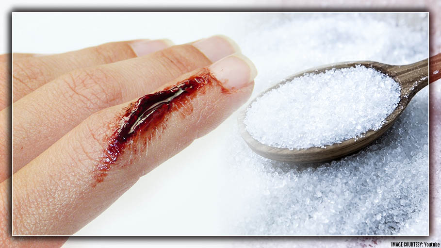 Injured? Sprinkle Some Sugar for a Faster Healing: Studies Reveal