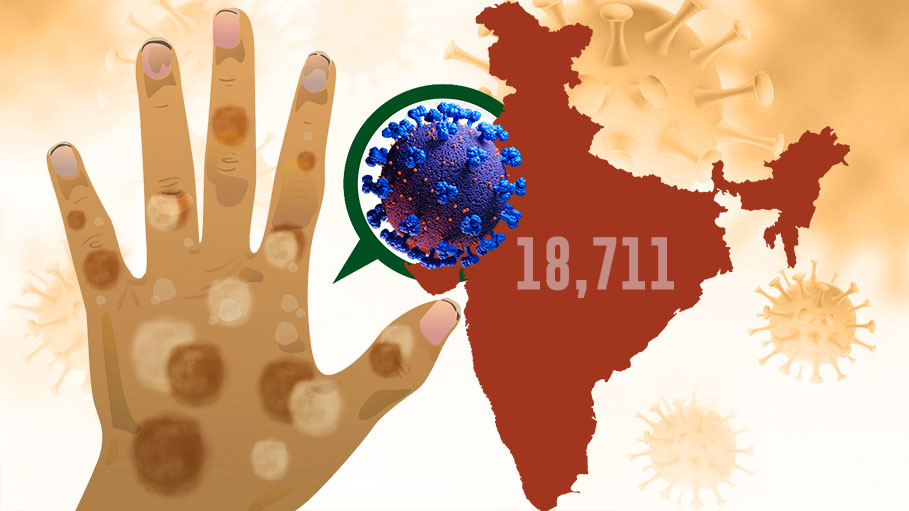 India Records 18,711 New COVID-19 Cases, Active Cases Rise Again