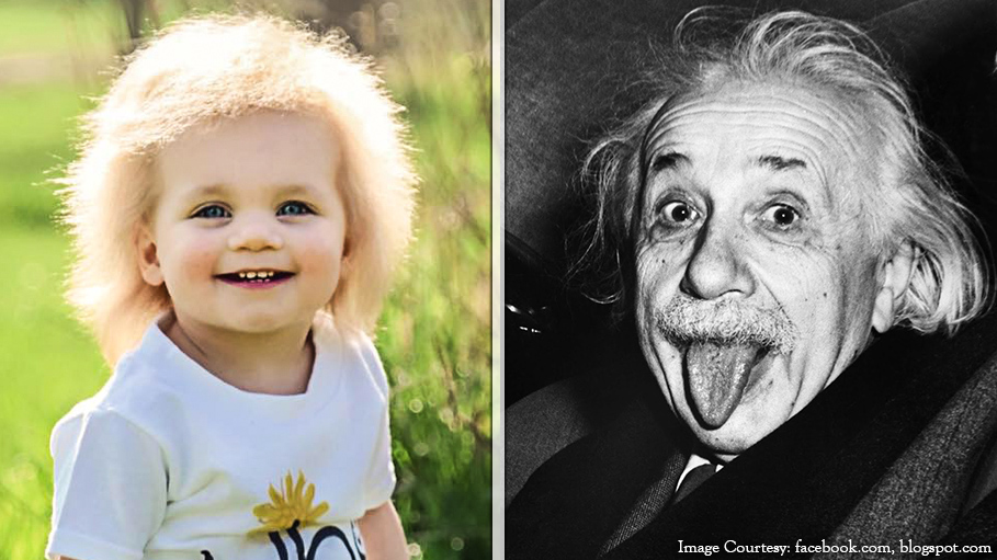 ‘Baby Einstein 2.0’ Draws Crowd Due to Her Rare Hair Condition Named ‘Uncombable Hair Syndrome’