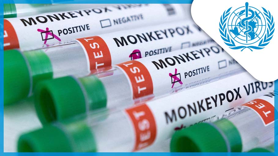 Emergency Meet to Assess if Monkeypox Global Health Emergency