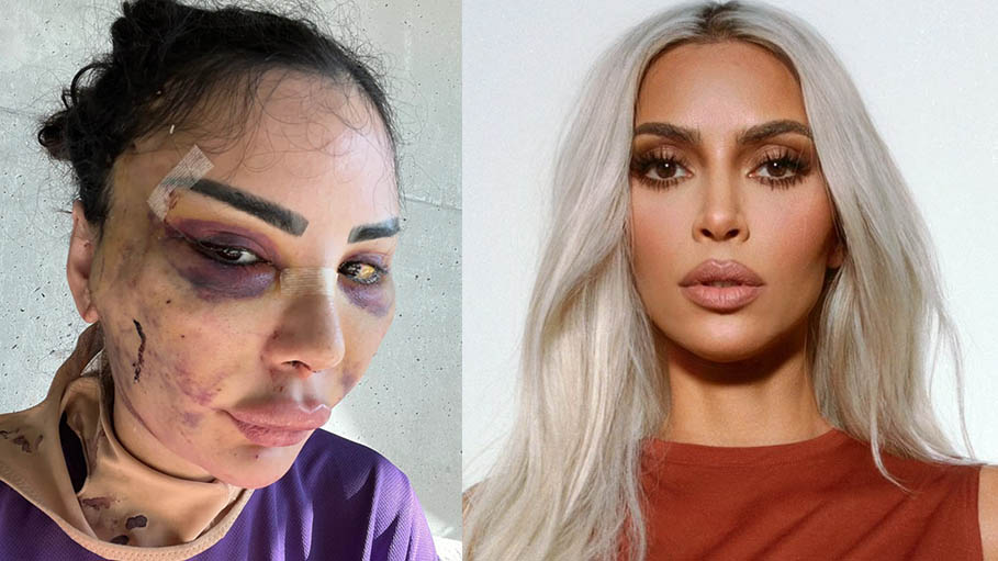 Model Spends 600k To Look Like Kim Kardashian And Spends 120k To Get Back Her Real Identity 