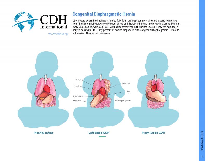 Image of CDH International