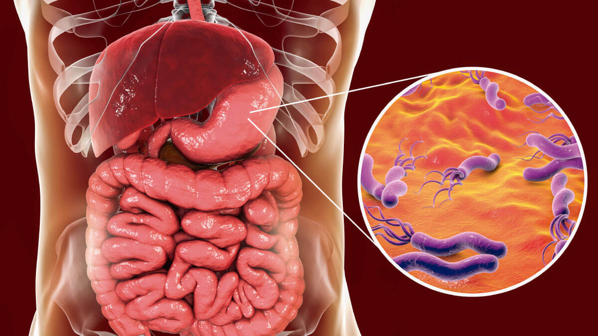 ¿Cómo controlar la gastritis crónica?