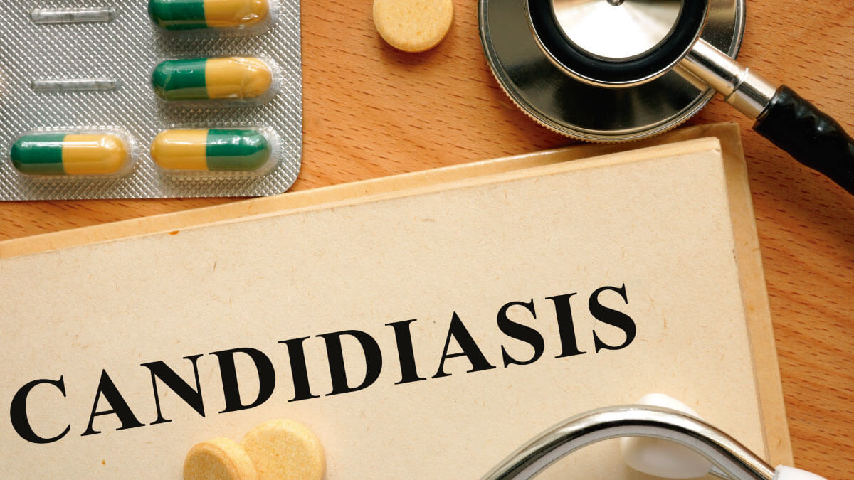 Tratamiento para la candidiasis y síntomas