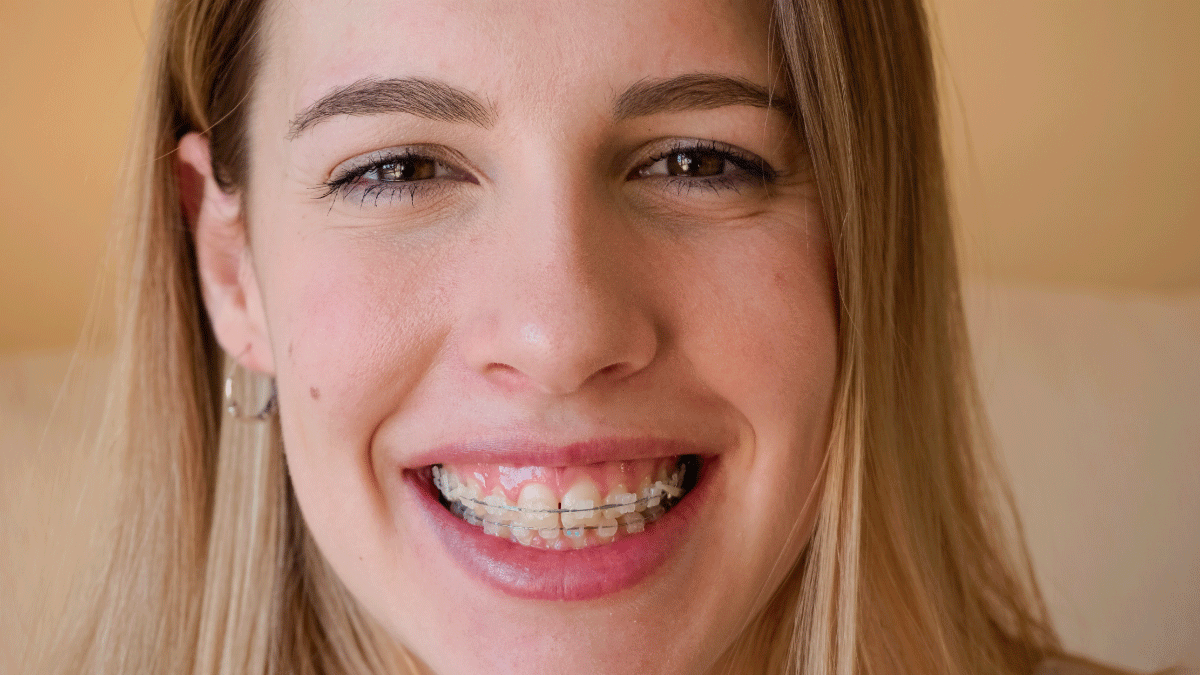 ¿Cómo usar seda dental con brackets?