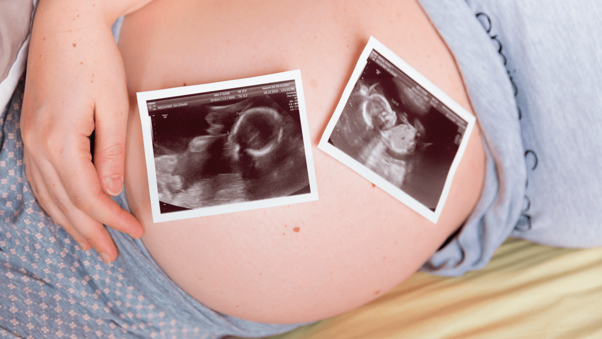 Embarazos múltiples. ¿Qué es? y causas