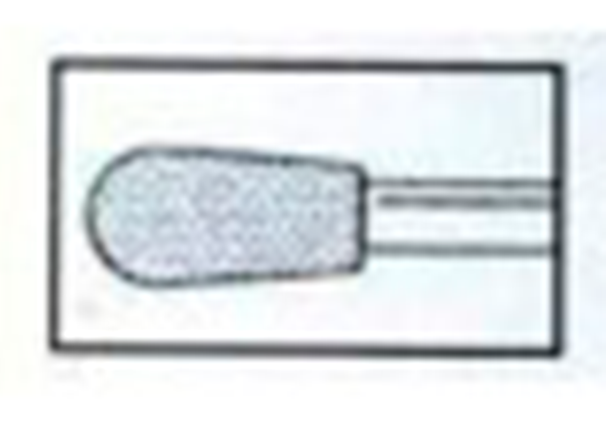 Chirex Diamond Burs