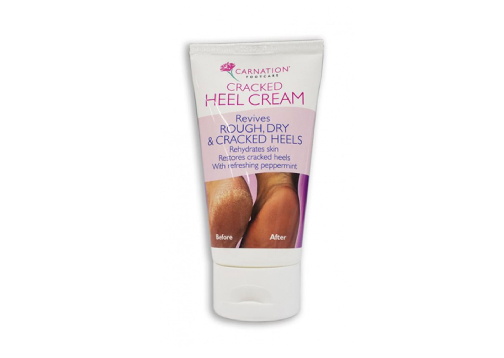 Cracked Heel Cream - 50g Tube