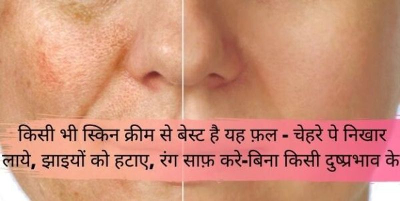 किसी भी स्किन क्रीम से बेस्ट है ये - चेहरे पे निखार लाये, झाइयों (Pigmentation) को हटाए, रंग साफ़ करे-बिना किसी दुष्प्रभाव के