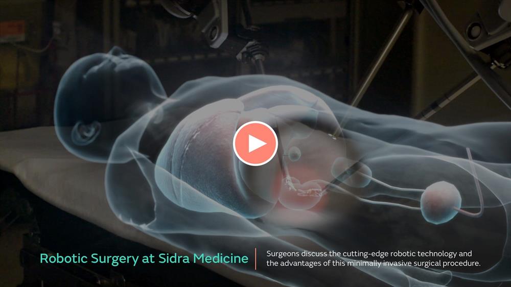 Robotic Surgery at Sidra Medicine