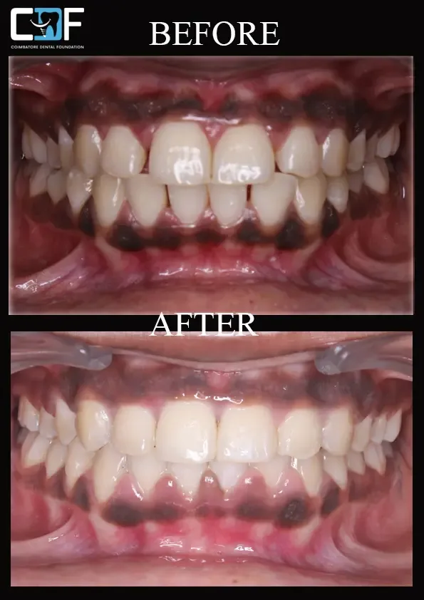 Coimbatore Dental Foundation screenshot 1
