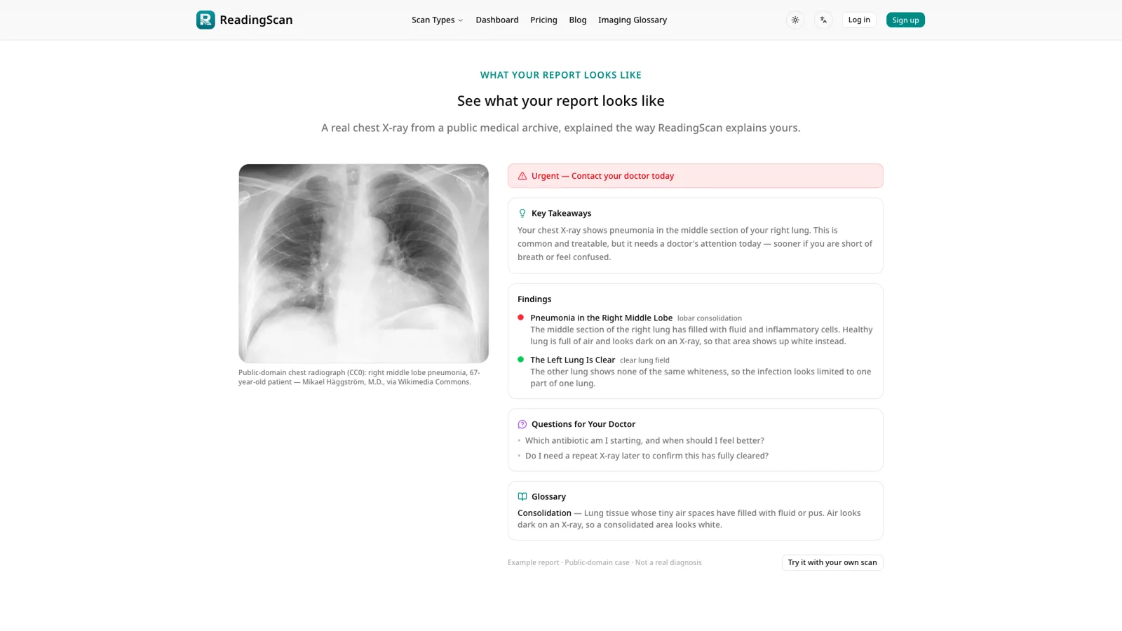 ReadingScan screenshot 2