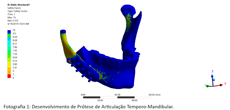 Protese de articulacao