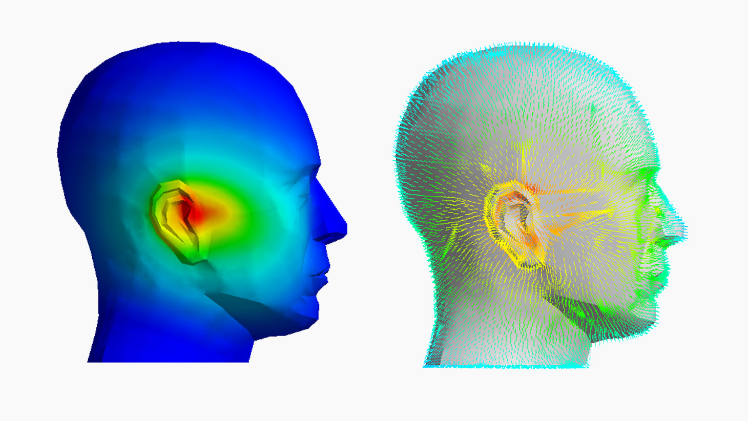 Medical Digital Twin: Simulación ANSYS lidera el cambio