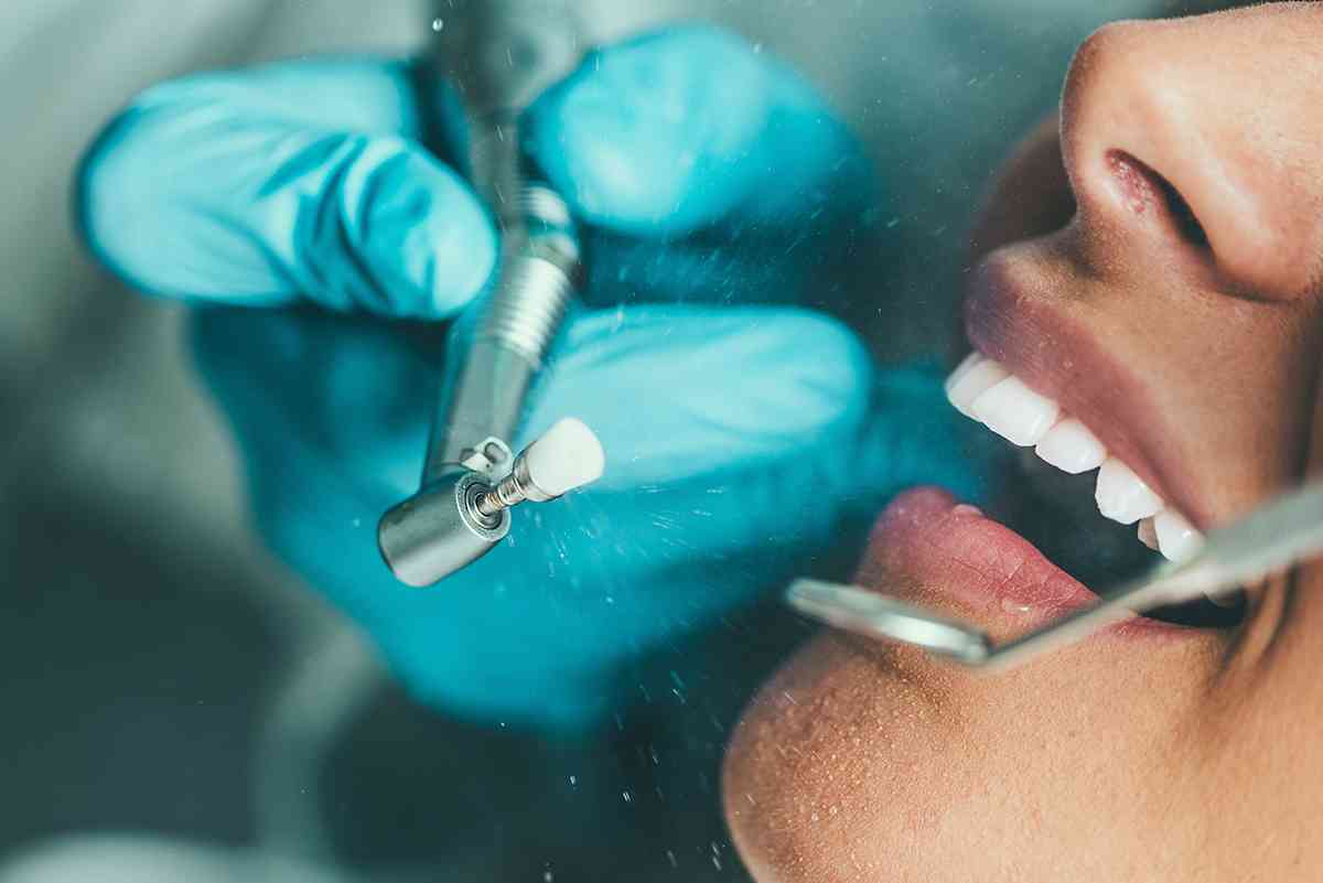 Limpieza dental + fluor (Barniz) 
