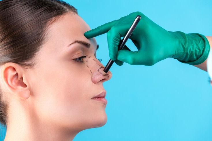 Rhinoplasty Recovery: Tips and Tricks